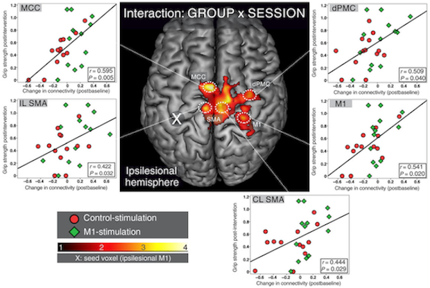 stroke_reorg